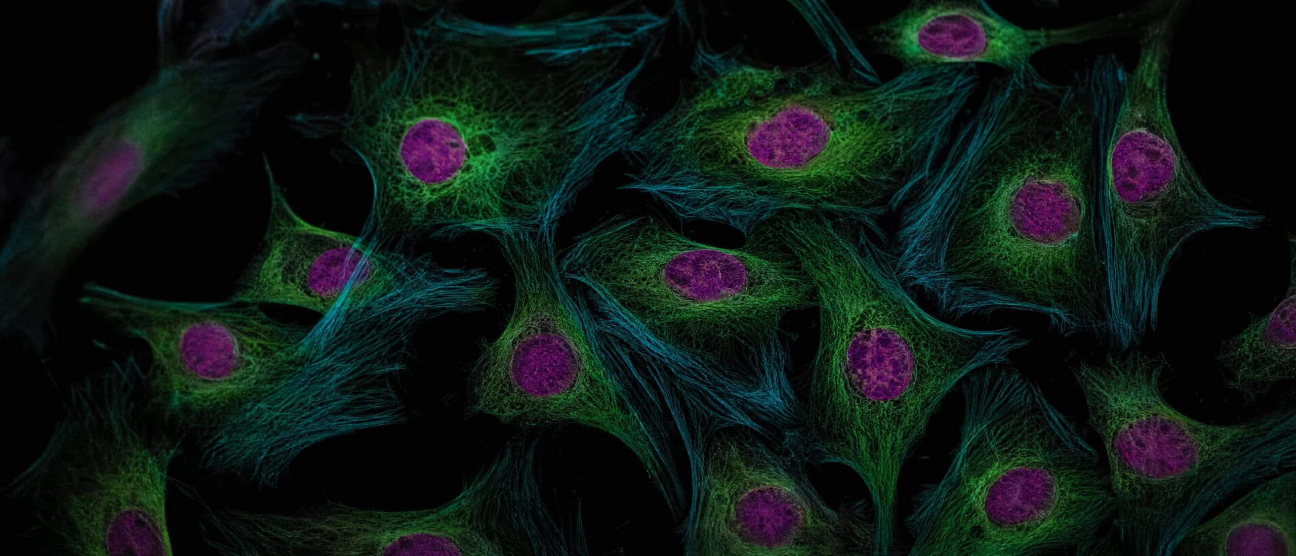 A fluorescence microscopy field: cells with magenta nuclei and a cyan cytoskeleton against a dark ground.